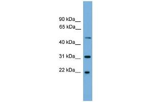WB Suggested Anti-CRYBA4 Antibody Titration: 0.