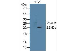 Figure. (GSTT1 Antikörper  (AA 7-240))
