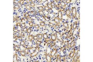 Immunohistochemistry (Paraffin-embedded Sections) (IHC (p)) image for anti-Heat Shock 60kDa Protein 1 (Chaperonin) (HSPD1) antibody (ABIN7074167)