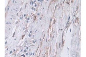 Immunohistochemistry (IHC) image for anti-Carboxypeptidase A4 (CPA4) (AA 55-421) antibody (ABIN7435982)
