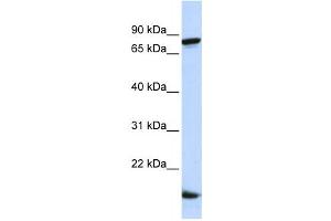 Western Blotting (WB) image for anti-Zinc Finger Protein 281 (ZNF281) antibody (ABIN2458356) (ZNF281 Antikörper)