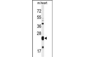 Western Blotting (WB) image for anti-Myeloid Leukemia Factor 1 (MLF1) (AA 215-244), (C-Term) antibody (ABIN652233)