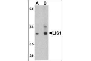 Western blot analysis of LIS1 in HeLa cell lysate AP30511PU-N at (A) 0. (PAFAH1B1 Antikörper  (C-Term))