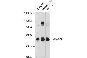 Western blot analysis of extracts of various cell lines, using SLC30 Antibody  at 1:3000 dilution. (SLC30A6 Antikörper  (AA 252-461))