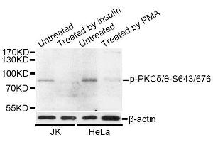 Western blot analysis of extracts of HeLa and 293 cells, using Phospho-PKCδ/θ-S643/676 antibody (ABIN5996816) at 1/1000 dilution. (PKC delta/theta (pSer643), (pSer676) Antikörper)