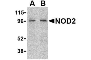 Image no. 1 for anti-Phorbol-12-Myristate-13-Acetate-Induced Protein 1 (PMAIP1) (N-Term) antibody (ABIN318707) (NOXA Antikörper  (N-Term))