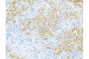 Immunohistochemistry (IHC) image for anti-Epithelial Cell Adhesion Molecule (EPCAM) (AA 24-265) antibody (ABIN7455170)
