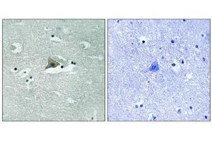 Immunohistochemical analysis of paraffin-embedded human brain tissue using Claudin 5 (Phospho-Tyr217) antibody (left)or the same antibody preincubated with blocking peptide (right). (Claudin 5 Antikörper  (pTyr217))