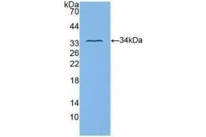 Detection of Recombinant ITGb3, Human using Polyclonal Antibody to Integrin Beta 3 (ITGb3) (Integrin beta 3 Antikörper  (AA 135-377))