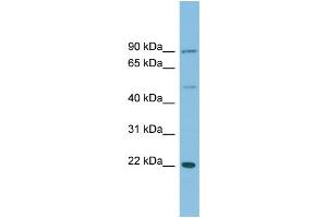 Western Blotting (WB) image for anti-DnaJ (Hsp40) Homolog, Subfamily C, Member 12 (DNAJC12) (Middle Region) antibody (ABIN2787274)