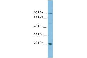 WB Suggested Anti-DNAJC12 Antibody Titration: 0. (DNAJC12 Antikörper  (Middle Region))