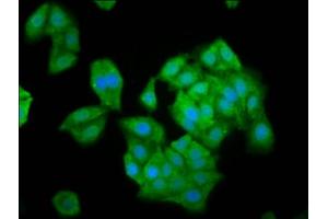 Immunofluorescence staining of HepG2 cells with ABIN7161327 at 1:100, counter-stained with DAPI. (NLN Antikörper  (AA 109-241))
