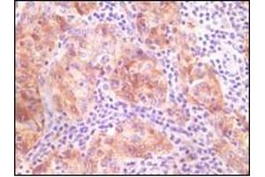 Immunohistochemistry (IHC) image for anti-Synuclein, gamma (Breast Cancer-Specific Protein 1) (SNCG) (truncated) antibody (ABIN2464104) (SNCG Antikörper  (truncated))