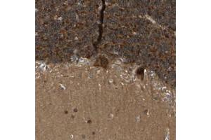 Immunohistochemical staining of human cerebellum with NDRG3 polyclonal antibody  shows strong cytoplasmic positivity in purkinje cells and in cells of granular layer at 1:20-1:50 dilution. (NDRG3 Antikörper)