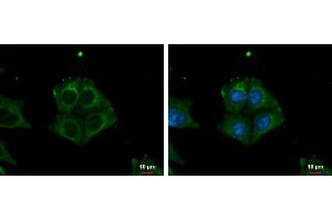 ICC/IF Image TRIM32 antibody detects TRIM32 protein at cytoplasm by immunofluorescent analysis. (TRIM32 Antikörper)