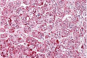 ABIN571194 (5µg/ml) staining of paraffin embedded Human Adrenal Gland. (ETFA Antikörper  (AA 139-152))