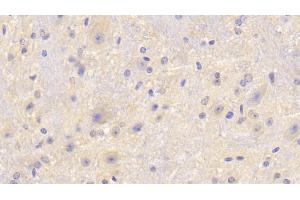Detection of F5 in Mouse Cerebellum Tissue using Polyclonal Antibody to Coagulation Factor V (F5) (Coagulation Factor V Antikörper  (AA 1863-2161))