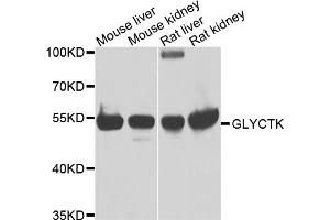 Western blot analysis of extracts of various cell lines, using GLYCTK antibody. (GLYCTK Antikörper)