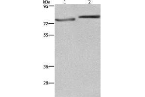 Western Blot analysis of PC3 and Hela cell using COMP Polyclonal Antibody at dilution of 1:600 (COMP Antikörper)