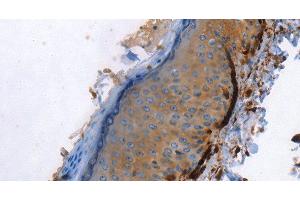 Immunohistochemistry of paraffin-embedded Human skin using Caldesmon Polyclonal Antibody at dilution of 1:40 (Caldesmon Antikörper)