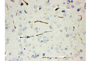 Calcitonin was detected in paraffin-embedded sections of mouse lung tissues using rabbit anti- Calcitonin Antigen Affinity purified polyclonal antibody (Catalog # ) at 1 µg/mL. (CGRP Antikörper  (C-Term))