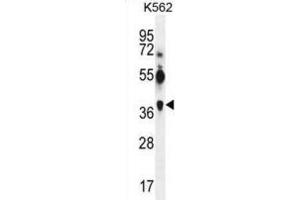 Western Blotting (WB) image for anti-Melanoma Antigen Family A, 12 (MAGEA12) antibody (ABIN3002530) (MAGEA12 Antikörper)