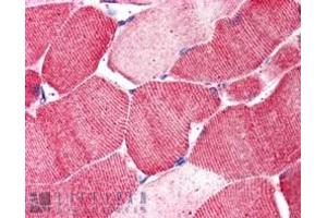 ABIN238566 (5µg/ml) staining of paraffin embedded Human Skeletal Muscle. (Arylsulfatase B Antikörper  (Internal Region))