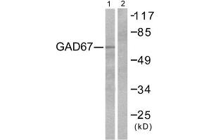 Western Blotting (WB) image for anti-Glutamate Decarboxylase 1 (Brain, 67kDa) (GAD1) (C-Term) antibody (ABIN1848556)
