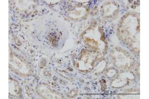 Image no. 4 for anti-Actin-Related Protein 2 (ACTR2) (AA 1-395) antibody (ABIN599116) (ACTR2 Antikörper  (AA 1-395))