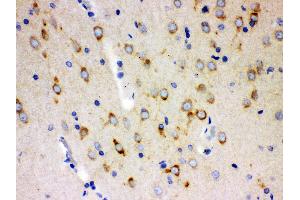 Anti- SSH3BP1 Picoband antibody, IHC(P) IHC(P): Rat Brain Tissue (ABI1 Antikörper  (N-Term))