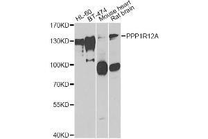 Western blot analysis of extracts of various cell lines, using PPP1R12A antibody. (PPP1R12A Antikörper)
