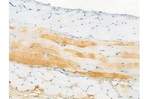 ABIN6256242 and ABIN6267094 at 1/100 staining Mouse skin tissue by IHC-P. (ATG14 Antikörper  (pSer29))