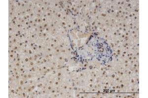 Immunoperoxidase of monoclonal antibody to NFIB on formalin-fixed paraffin-embedded human liver.