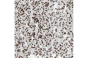 Immunohistochemical staining of human pancreas with CCAR1 polyclonal antibody  shows strong nuclear positivity in exocrine glandular cells. (CCAR1 Antikörper)