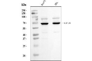 Western blot analysis of Glutaminase/GLS using anti-Glutaminase/GLS antibody (ABIN7601601).