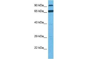 Host:  Rabbit  Target Name:  RHBDF1  Sample Tissue:  Human PANC1 Whole Cell  Antibody Dilution:  1ug/ml (RHBDF1 Antikörper  (N-Term))