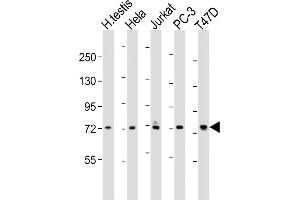 All lanes : Anti-TNK1 Antibody (C-term) at 1:1000-1:2000 dilution Lane 1: human testis lysates Lane 2: Hela whole cell lysates Lane 3: Jurkat whole cell lysates Lane 4: PC-3 whole cell lysates Lane 5: T47D whole cell lysates Lysates/proteins at 20 μg per lane.