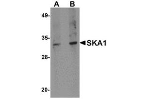 Western blot analysis of SKA1 in A549 cell lysate with SKA1 antibody at 0. (SKA1 Antikörper  (C-Term))