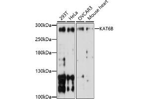Western blot analysis of extracts of various cell lines, using KB antibody (ABIN7268062) at 1:1000 dilution. (KAT6B Antikörper  (AA 400-500))