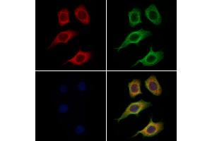 ABIN6265828 and ABIN6269033 staining Hela cells by IF/ICC. (TYR Antikörper  (C-Term))