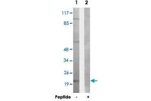 Western blot analysis of extracts from HepG2 cells, using LTB polyclonal antibody . (LTB Antikörper  (C-Term))