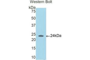 Western blot analysis of the recombinant protein. (CCDC80 Antikörper  (AA 81-258))