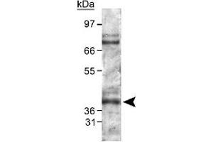 Western blot analysis of PHD2 in mouse kidney lysate using Egln1 polyclonal antibody .