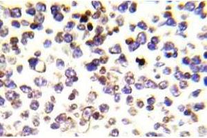 Immunohistochemistry (IHC) analyzes of Histone H2A. (H2AFX Antikörper)