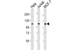 All lanes : Anti-EXOC4 Antibody (N-term) at 1:2000 dilution Lane 1: Hela whole cell lysates Lane 2: Jurkat whole cell lysates Lane 3: MCF-7 whole cell lysates Lysates/proteins at 20 μg per lane. (Sec8 Antikörper  (N-Term))