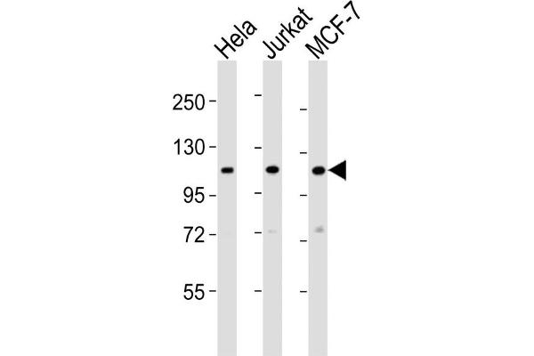 Sec8 antibody  (N-Term)