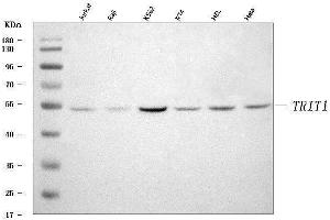 Western blot analysis of IPT/TRIT1 using anti-IPT/TRIT1 antibody (ABIN7600178).