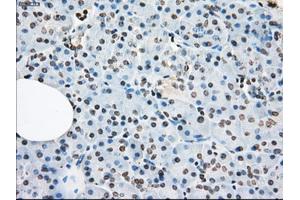 Immunohistochemical staining of paraffin-embedded colon tissue using anti-XRCC4mouse monoclonal antibody. (LTA4H Antikörper)