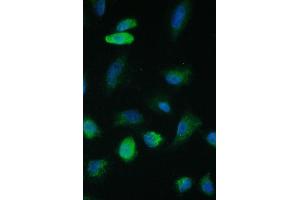 IF analysis of TIMM17A using anti-TIMM17A antibody (ABIN6719637). (TIMM17A Antikörper)