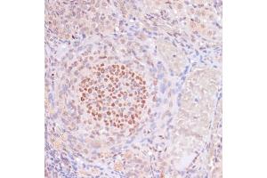 Immunohistochemistry of paraffin-embedded rat ovary using Acetyl-Histone H3-K23 antibody (ABIN7267669) at dilution of 1:100 (40x lens).